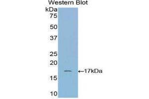 Western Blotting (WB) image for anti-Ribonuclease, RNase A Family, 1 (Pancreatic) (RNASE1) (AA 31-150) antibody (ABIN1172716) (RNASE1 Antikörper  (AA 31-150))