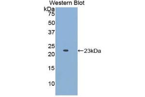 Detection of Recombinant APOE, Human using Polyclonal Antibody to Apolipoprotein E (APOE) (APOE Antikörper  (AA 19-181))