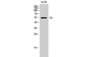 Western Blotting (WB) image for anti-Ets Variant 6 (ETV6) (Ser37) antibody (ABIN3177671) (ETV6 Antikörper  (Ser37))