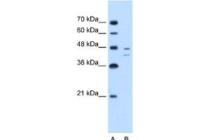 FAH antibody - C-terminal region  validated by WB using Jurkat cell lysate at 2.
