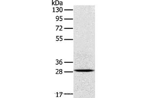 Western blot analysis of Mouse brain tissue, using TREM2 Polyclonal Antibody at dilution of 1:250 (TREM2 Antikörper)