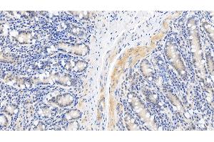 Immunohistochemistry (IHC) image for anti-Caspase 1 (CASP1) (AA 120-297) antibody (ABIN7437272)