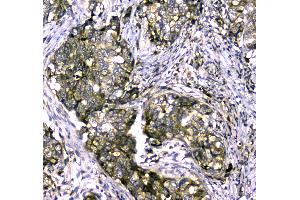 Immunohistochemistry (IHC) image for anti-Myosin Binding Protein C, Cardiac (MYBPC3) (AA 1070-1123) antibody (ABIN5693035)