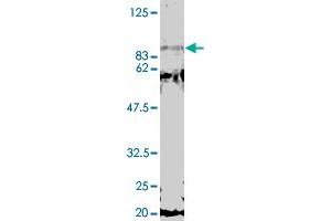 Detection of GCN5 by Western blotting using the GCN5 polyclonal antibody  . (MED17 Antikörper)