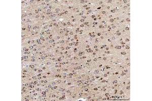 IHC analysis of EEA1 using anti-EEA1 antibody (ABIN5692856). (EEA1 Antikörper)