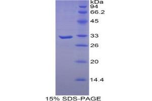 SDS-PAGE analysis of Human Myosin Heavy Chain 16 Protein.