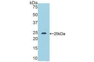 Western blot analysis of recombinant Mouse DSC1. (Desmocollin 1 Antikörper  (AA 135-340))