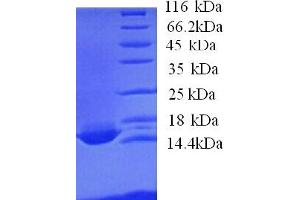 SDS-PAGE (SDS) image for Apolipoprotein C-IV (APOC4) (AA 27-127) protein (His tag) (ABIN5713248)