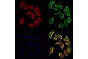 ABIN6265372 and ABIN6272932 staining Hela cells by IF/ICC. (SULT4A1 Antikörper  (C-Term))