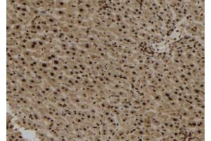 ABIN6273166 at 1/100 staining Mouse liver tissue by IHC-P. (SPG11 Antikörper  (Internal Region))