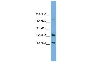 GM2A antibody used at 1 ug/ml to detect target protein.