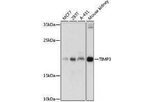Western blot analysis of extracts of various cell lines using TIMP3 Polyclonal Antibody at dilution of 1:1000. (TIMP3 Antikörper)