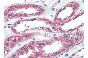 Human Kidney (formalin-fixed, paraffin-embedded) stained with ARHGEF17at 5 µg/ml followed by biotinylated goat anti-rabbit IgG secondary antibody, alkaline phosphatase-streptavidin and chromogen. (ARHGEF17 Antikörper)