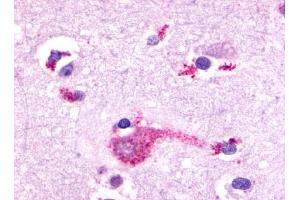 Immunohistochemical staining of Brain (Neurons and glia) using anti- GRM2 antibody ABIN122313 (GRM2 Antikörper  (N-Term))