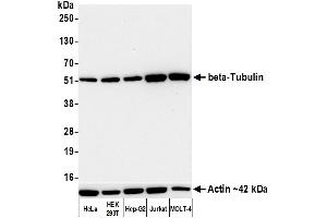 Western Blotting (WB) image for anti-Tubulin, beta (TUBB) (AA 1-50) antibody (ABIN7453995) (Rekombinanter TUBB Antikörper  (AA 1-50))
