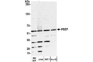 Western Blotting (WB) image for anti-Nicotinamide phosphoribosyltransferase (NAMPT) (AA 400-450) antibody (ABIN7454619)