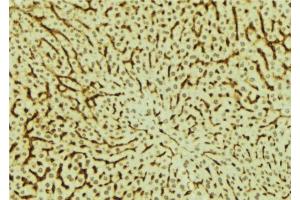 ABIN6279527 at 1/100 staining Mouse liver tissue by IHC-P. (MED28 Antikörper  (Internal Region))