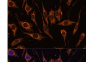 Immunofluorescence (IF) image for anti-Coiled-Coil Domain Containing 6 (CCDC6) antibody (ABIN7258894)