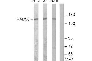 Western Blotting (WB) image for anti-RAD50 Homolog (S. Cerevisiae) (RAD50) (Internal Region) antibody (ABIN1850502) (RAD50 Antikörper  (Internal Region))