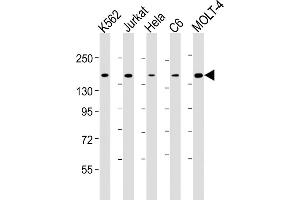 All lanes : Anti-CTCF Antibody at 1:4000 dilution Lane 1: K562 whole cell lysate Lane 2: Jurkat whole cell lysate Lane 3: Hela whole cell lysate Lane 4: C6 whole cell lysate Lane 5: MOLT-4 whole cell lysate Lysates/proteins at 20 μg per lane. (CTCF Antikörper  (AA 445-727))