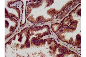 IHC image of ABIN7144958 diluted at 1:500 and staining in paraffin-embedded human prostate tissue performed on a Leica BondTM system.
