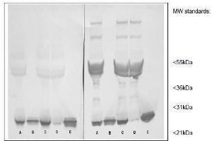 Western Blotting (WB) image for anti-C-Reactive Protein (CRP) antibody (ABIN781723) (CRP Antikörper)