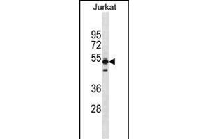 TO Antibody (Center) (ABIN1538173 and ABIN2838131) western blot analysis in Jurkat cell line lysates (35 μg/lane). (Thymopoietin Antikörper  (AA 243-269))