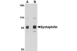 Image no. 1 for anti-Syntaphilin (SNPH) (Internal Region) antibody (ABIN1493822)