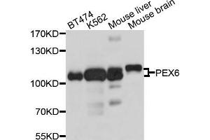 Western blot analysis of extracts of various cell lines, using PEX6 antibody (ABIN5998494) at 1/1000 dilution. (PEX6 Antikörper)