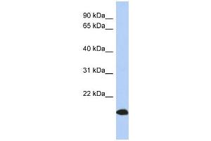 ARL17 antibody used at 1 ug/ml to detect target protein. (ARL17 Antikörper  (Middle Region))