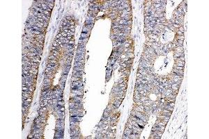 Immunohistochemistry (IHC) image for anti-Ephrin Type A Receptor 1 (EPHA1) (C-Term) antibody (ABIN3030829)