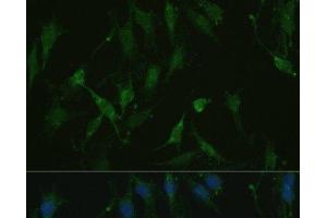 Immunofluorescence analysis of C6 cells using TRPV1 Polyclonal Antibody at dilution of 1:100. (TRPV1 Antikörper)