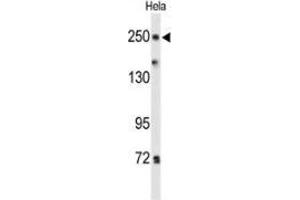 Western Blotting (WB) image for anti-Protein tyrosine Phosphatase, Receptor Type, D (PTPRD) (AA 350-379), (N-Term) antibody (ABIN954379)