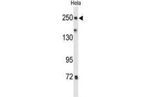 Western blot analysis of PTPRD(arrow) in Hela cell line lysates (35ug/lane) using PTPRD  Antibody  (N-term). (PTPRD Antikörper  (N-Term))