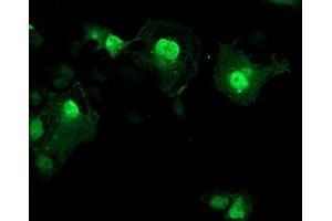Immunofluorescence (IF) image for anti-Aryl Hydrocarbon Receptor Interacting Protein-Like 1 (AIPL1) antibody (ABIN1496509) (AIPL1 Antikörper)