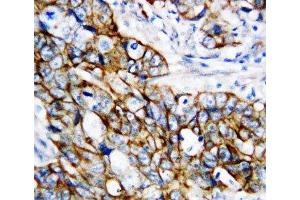 Immunohistochemistry (IHC) image for anti-Catenin, beta (CATNB) (N-Term) antibody (ABIN3030327)