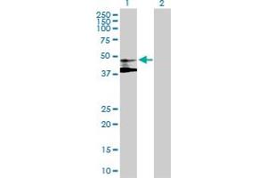 Western Blot analysis of ST3GAL3 expression in transfected 293T cell line by ST3GAL3 MaxPab polyclonal antibody. (ST3GAL3 Antikörper  (AA 1-390))