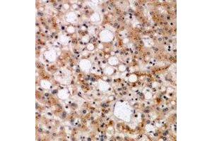 Immunohistochemical analysis of SPFH1 staining in human liver formalin fixed paraffin embedded tissue section. (ERLIN1 Antikörper)