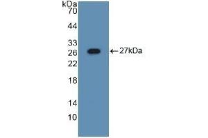 Detection of Recombinant ASGR1, Mouse using Polyclonal Antibody to Asialoglycoprotein Receptor 1 (ASGR1) (Asialoglycoprotein Receptor 1 Antikörper  (AA 80-281))