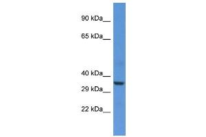 Western Blotting (WB) image for anti-Heme Oxygenase (Decycling) 1 (HMOX1) (N-Term) antibody (ABIN2782158)