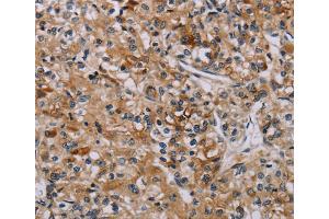 Immunohistochemistry (IHC) image for anti-Apoptosis-Associated tyrosine Kinase (AATK) antibody (ABIN2827106) (AATK Antikörper)