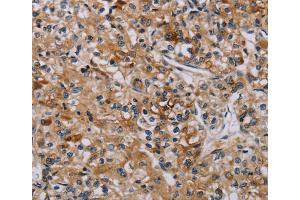 Immunohistochemistry (IHC) image for anti-Apoptosis-Associated tyrosine Kinase (AATK) antibody (ABIN5546867) (AATK Antikörper)