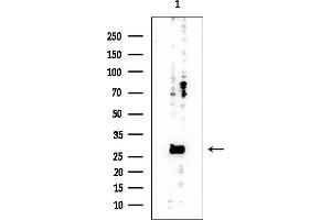 anti-Dolichyl Pyrophosphate Phosphatase 1 (DOLPP1) antibody