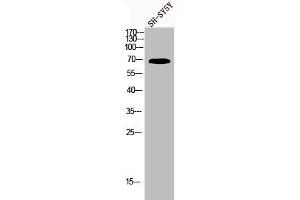 Western Blotting (WB) image for anti-Potassium Voltage-Gated Channel, Shaw-Related Subfamily, Member 4 (KCNC4) antibody (ABIN7181851)