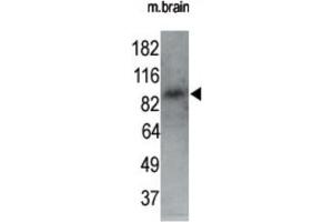 Western Blotting (WB) image for anti-MAP/microtubule Affinity-Regulating Kinase 1 (MARK1) antibody (ABIN2995250) (MARK1 Antikörper)