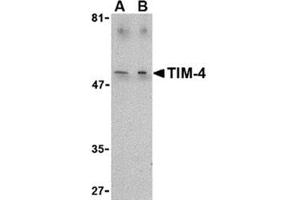 Image no. 1 for anti-T-Cell Immunoglobulin and Mucin Domain Containing 4 (TIMD4) (C-Term) antibody (ABIN318767) (TIMD4 Antikörper  (C-Term))