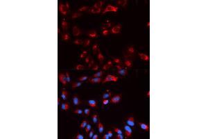 Immunofluorescence (IF) image for anti-Complement Factor P (CFP) antibody (ABIN1876586) (CFP Antikörper)