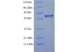 SDS-PAGE (SDS) image for ER Membrane Protein Complex Subunit 9 (EMC9) (AA 1-208), (full length) protein (His-SUMO Tag) (ABIN5712017) (EMC9 Protein (AA 1-208, full length) (His-SUMO Tag))