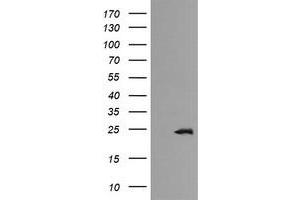 Image no. 1 for anti-RAB21, Member RAS Oncogene Family (RAB21) antibody (ABIN1500548) (RAB21 Antikörper)