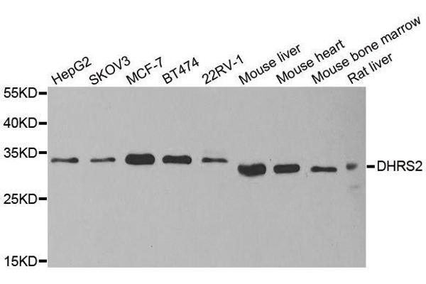 DHRS2 Antikörper  (AA 1-300)